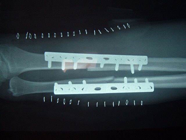 Posted Image